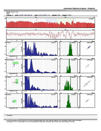 Advance Autonomic Balance Analysis